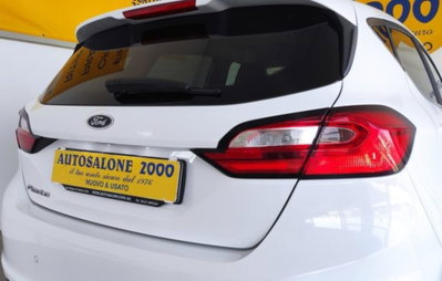 Ford Fiesta 1.1 75 CV GPL 5 porte Titanium (8)