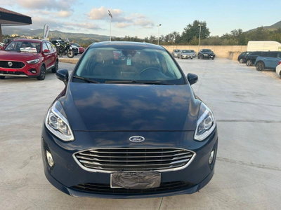 Ford Fiesta 1.1 75 CV GPL 5 porte Titanium (2)