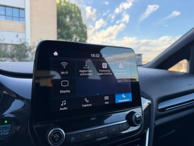Ford Fiesta 1.0 EcoBoost 100CV 3 porte ST-Line (11)