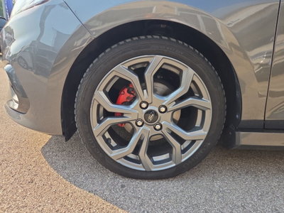 Ford Fiesta 1.5 EcoBlue 5 porte ST-Line (7)