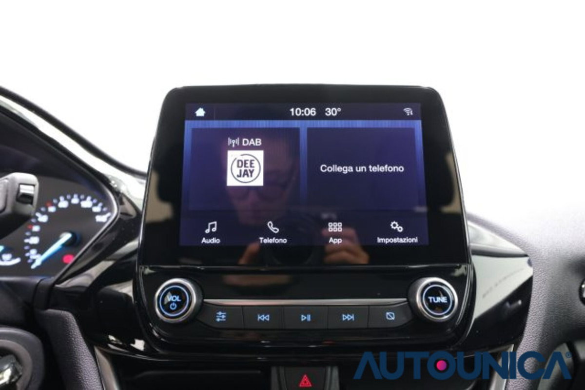 Ford Fiesta 1.1 75 CV 5 porte Titanium (9)