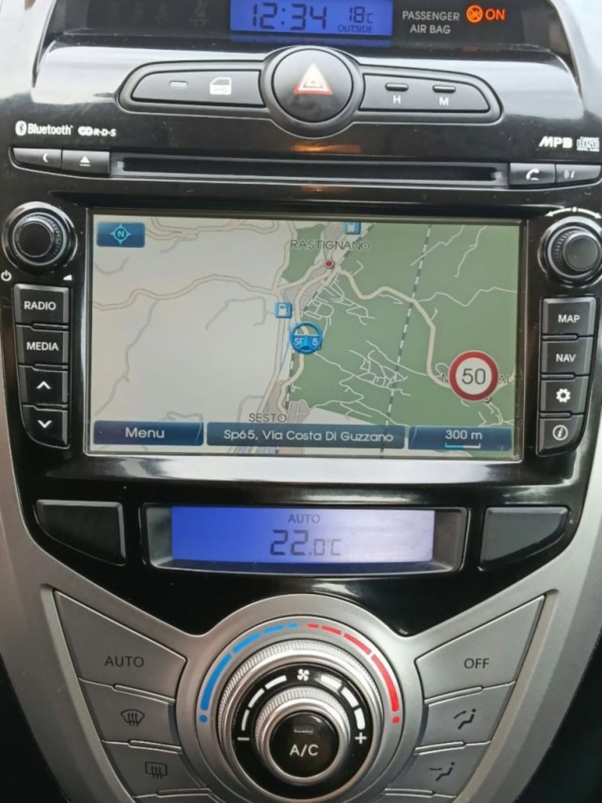 Hyundai ix20 1.4 CRDI 90 CV XPossible (6)