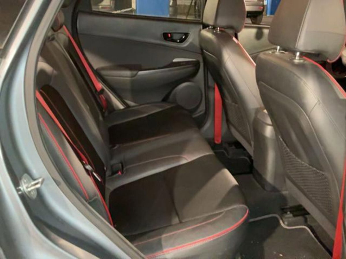 Hyundai Kona 1.6 CRDI 115 CV XPrime (5)